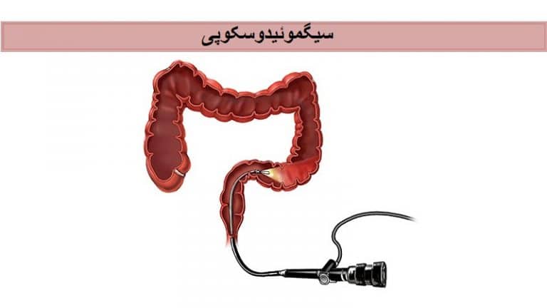 سیگموئیدوسکوپی