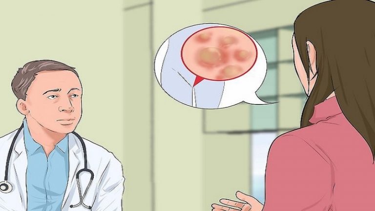 درمان زگیل تناسلی