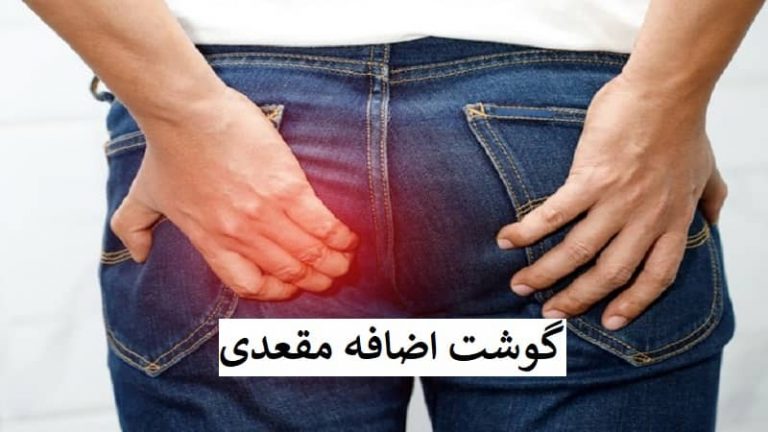 عکس گوشت اضافه مقعدی
