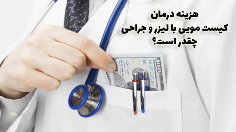 هزینه عمل کیست مویی با لیزر و جراحی در تهران