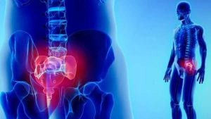 عکس کیست مویی