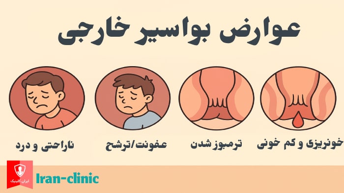 عکس عوارض بواسیر خارجی - ایران کلینیک