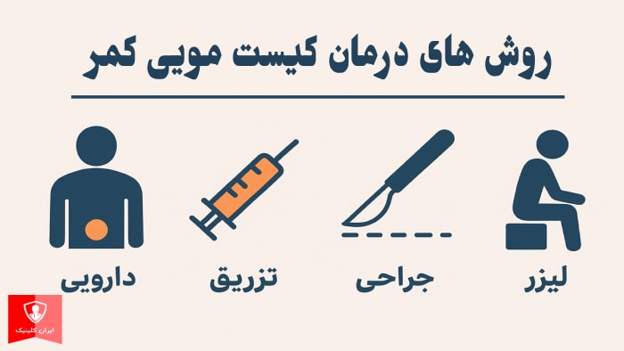 عکس روش های درمان کیست مویی کمر